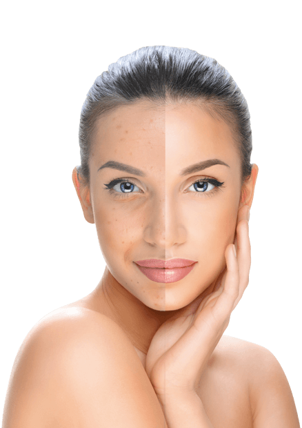 piperina-woman-1-2.png piperina-woman-1-2.png